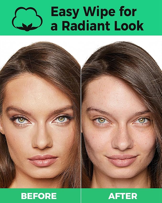 ProCIV Reusable Makeup Remover Pads - 16 Packs Washable Organic Reusable Cotton Rounds for All Skin Types & Toner with Laundry Bag, Zero Waste Reusable Cotton Pads for Face for Woman Gift (White)