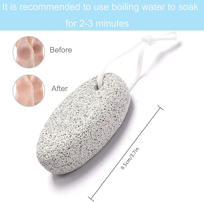 Natural Foot Pumice Stone for Feet, Borogo 5-Pack Lava Pedicure Tools Hard Skin Callus Remover for Feet and Hands - Natural Foot File Exfoliation to Remove Dead Skin, Heels, Elbows, Hands