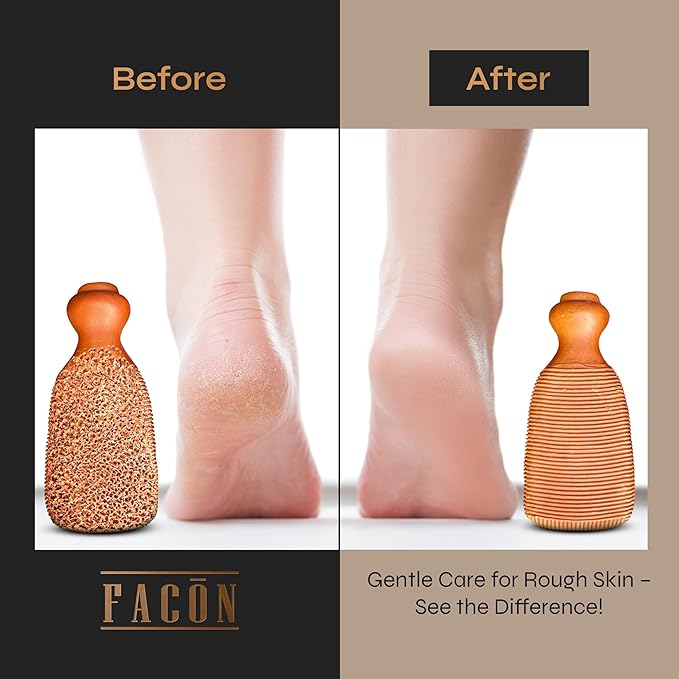 Facón Pumice Stone for Feet Callus Remover - Terra-Cotta Foot Scrubber with 2 Sides, 100% Pure Natural Foot Pumice Stone, Pedicure Pumice Stone Scrubber, Foot Exfoliator, Removes Calluses & Dead Skin