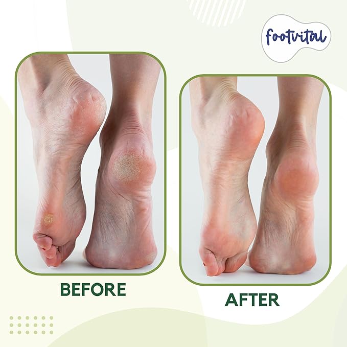 Pumice Stone for Feet Callus Remover - Terra-Cotta Foot Scrubber with 2 Sides, 100% Pure Natural Foot Pumice Stone, Pedicure Scrubber, Foot Exfoliator, Removes Calluses & Dead Skin