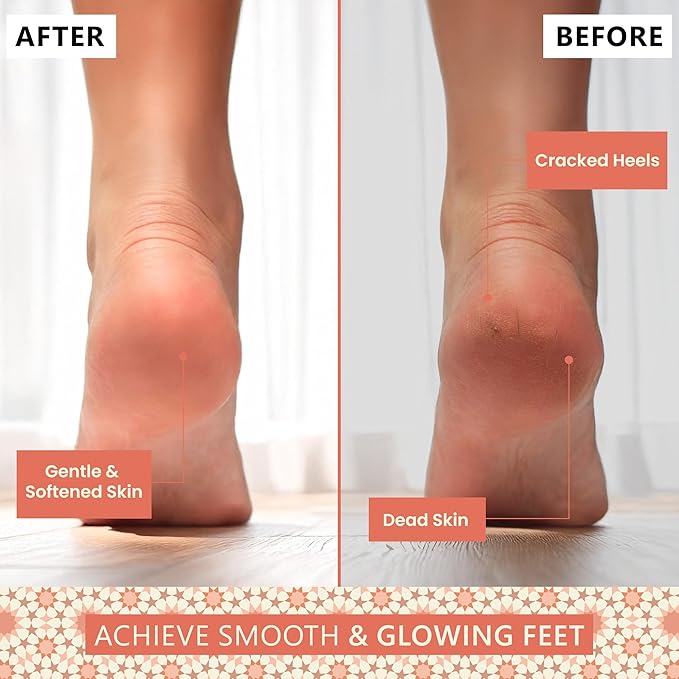 Natural Terracotta Pumice Stone for Feet – Handcrafted Foot Scrubber & Callus Remover with Gentle Exfoliation and Ergonomic Design for Smooth, Soft & Refreshed Feet – for a Spa-Like Pedicure